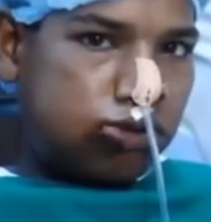 L’adolescent avait 232 dents en trop