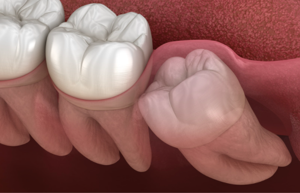 NatureBio Dental-Formation 32 secret-13