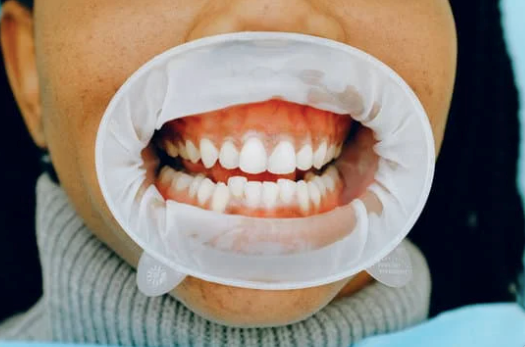 NatureBio Dental-Formation Chirurgiens dentistes-6